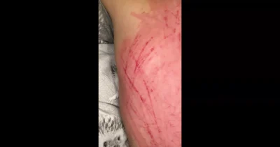 Back scratch Part 2 long natural nails